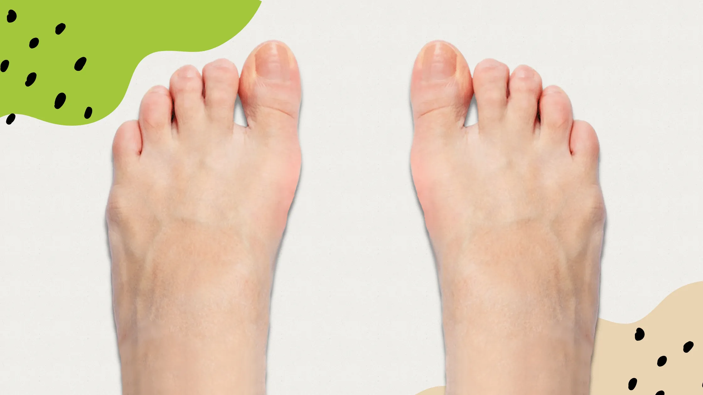 piedi innaturali