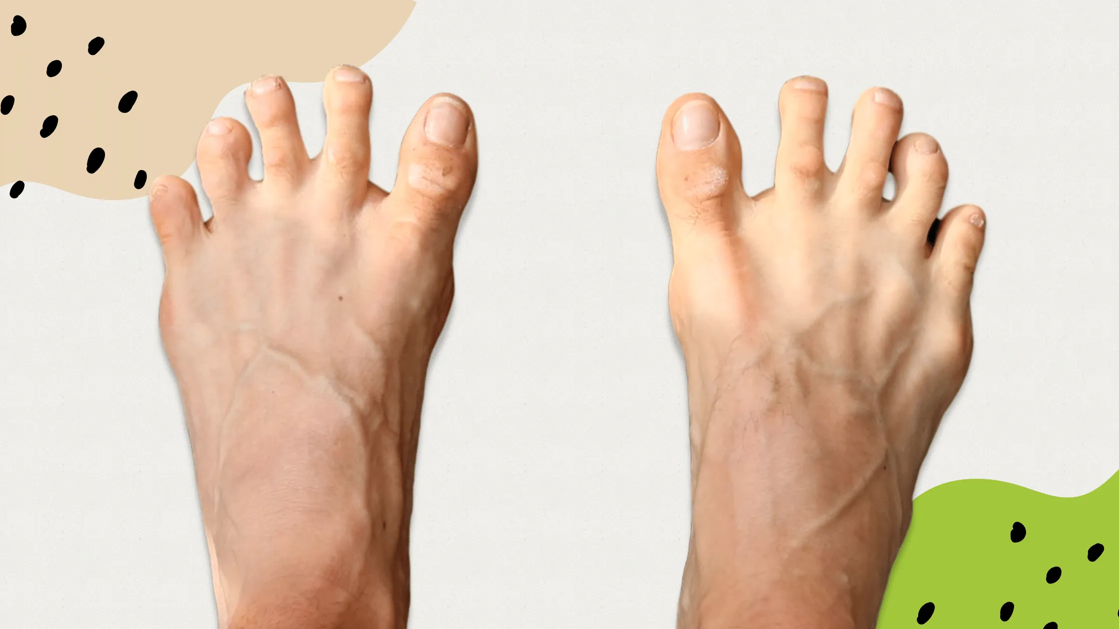 piedi naturali
